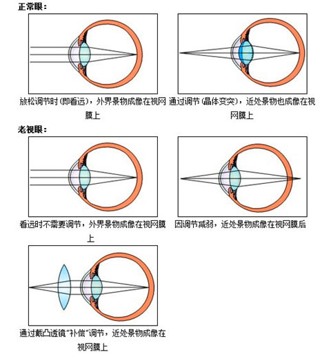 散瞳后孩子不能写作业怎么办？