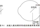 大散光弱视患者多次验光结果为何差别这么大？