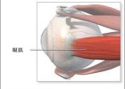 眼球震颤 并非无药可医