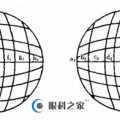 家长应该了解什么是异常视网膜对应关系